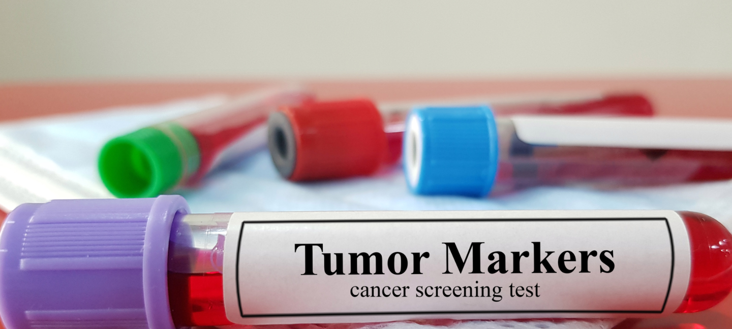 Kankeronderzoek - Onderzoek - Kanker - Reageerbuisjes
