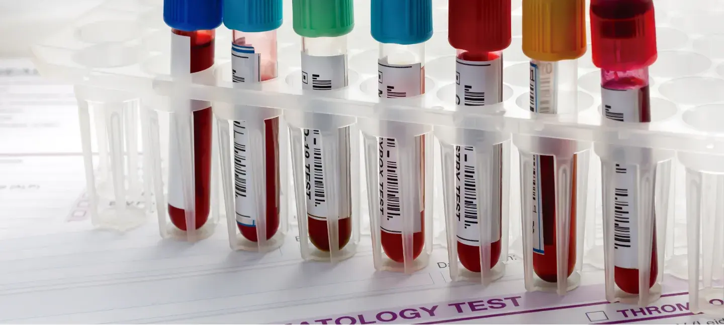 Biomarkers - Zorginnovatie - Onderzoek Zorg - R&D Zorg