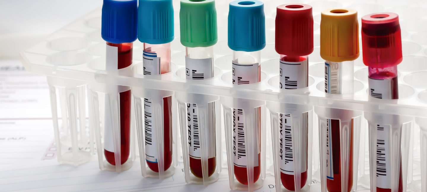 Biomarkers
