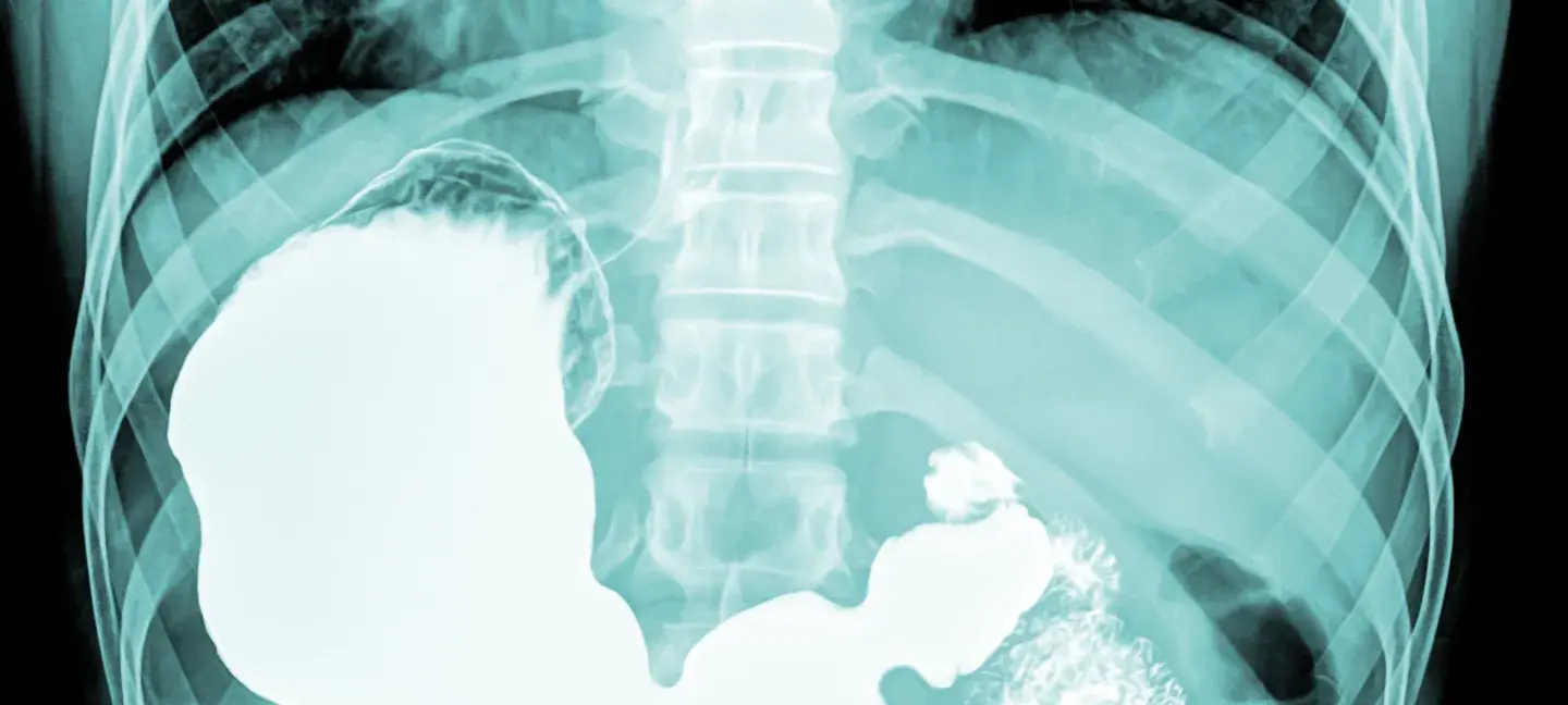 Rontgen - MDL - Maag - Lever - Darm