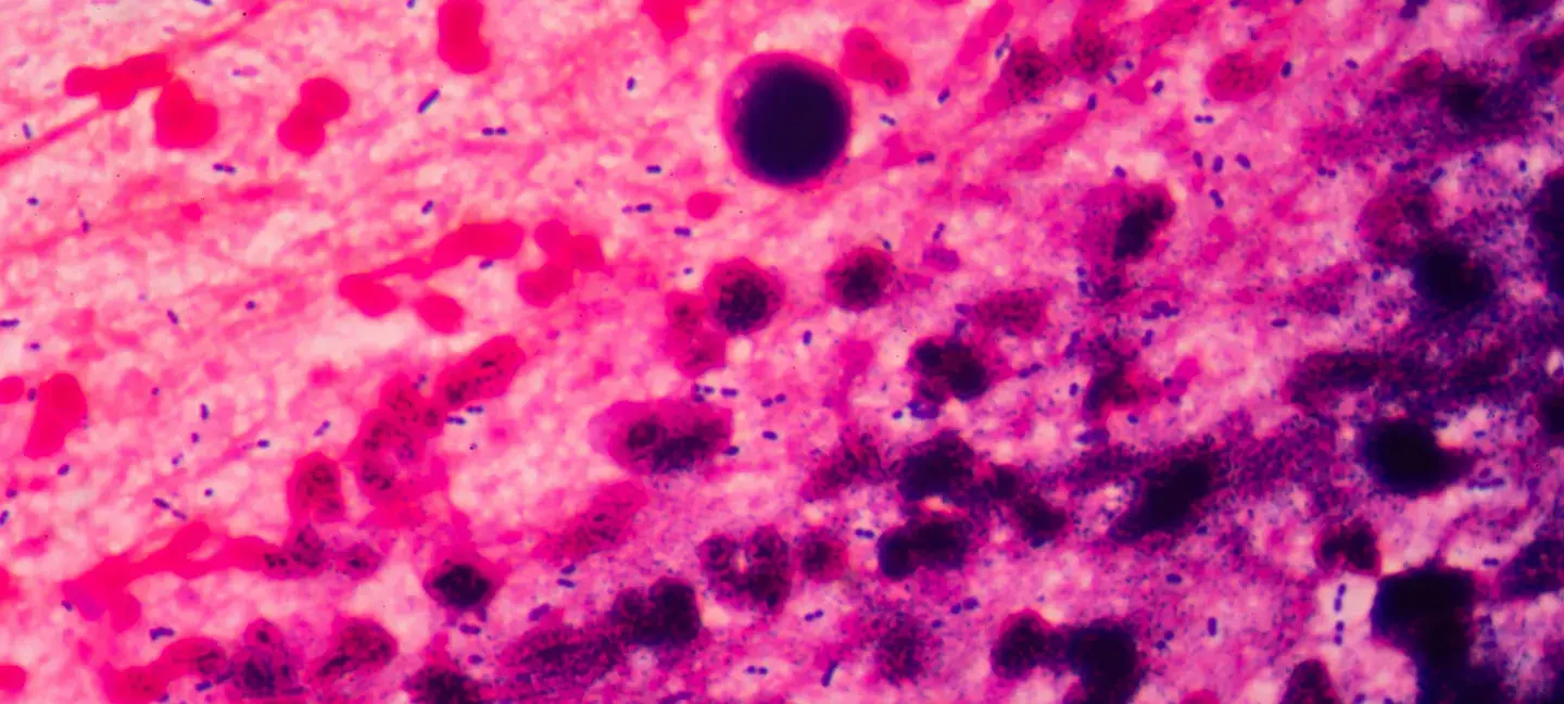 Immunologie - Vaccins - Immunologie